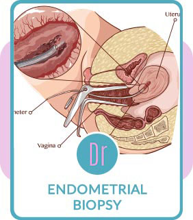 Endometrial Biopsy Near Me in Eugene OR