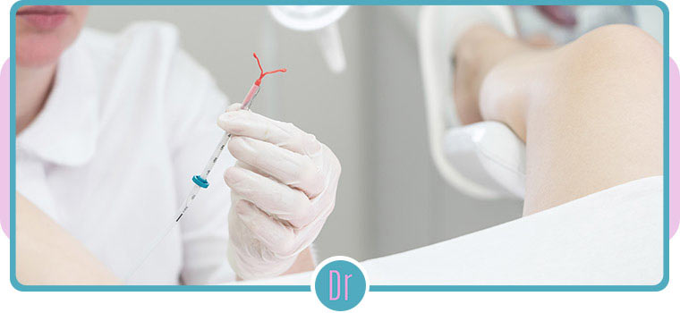 IUD Insertion and Removal Procedure Near Me in Eugene, OR IUD Insertion and Removal Procedure Near Me in Eugene, OR