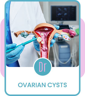 Ovarian Cysts Treatment Specialist Near Me in Eugene, OR